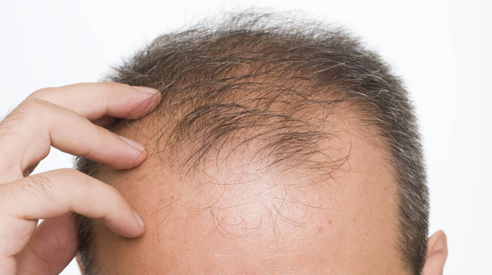 Ilmuwan Sebut Kadar Serin Rendah dapat Ubah Sel Induk Rambut