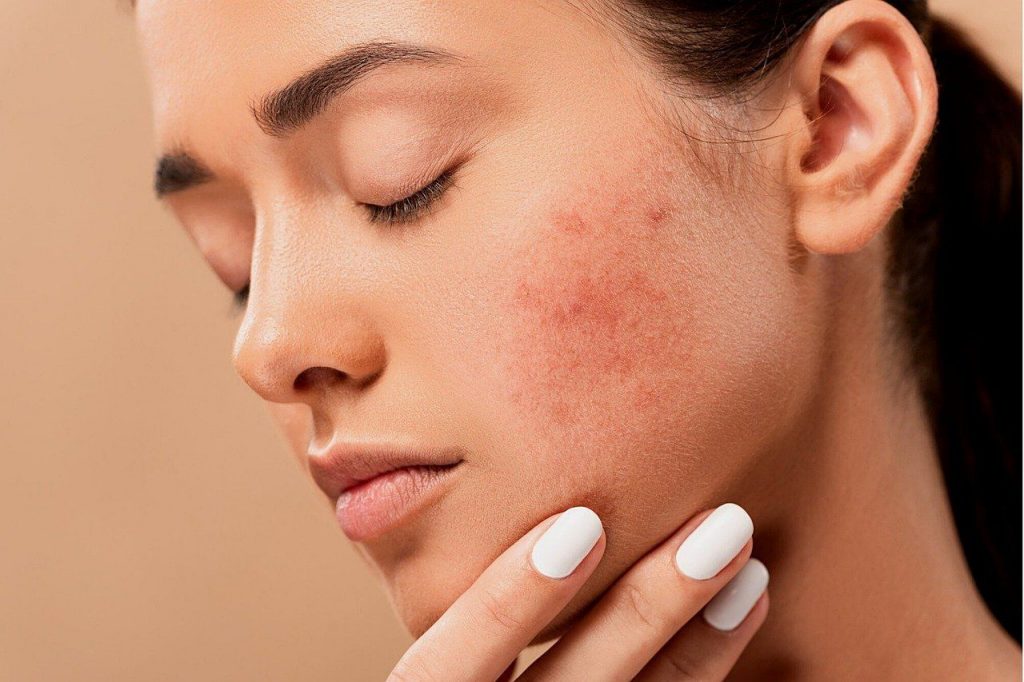 Mengenal Skin Barrier Sebagai Kunci Kesehatan Kulit Wajah