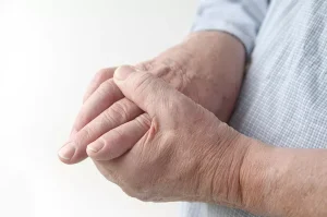 Fenomena Raynaud, Reaksi Tubuh Berlebihan terhadap Dingin dan Stres