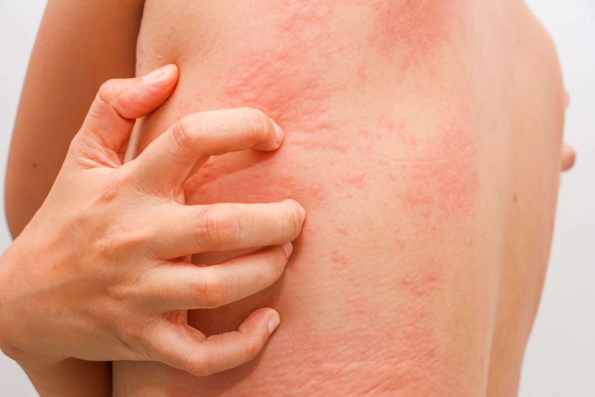 Pruritus Kronis, Tantangan Diagnosis pada Gatal Berkepanjangan