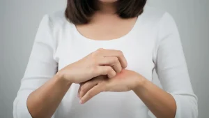 Pengobatan Penyakit Tidak Menular dengan Perawatan Kulit yang Tepat