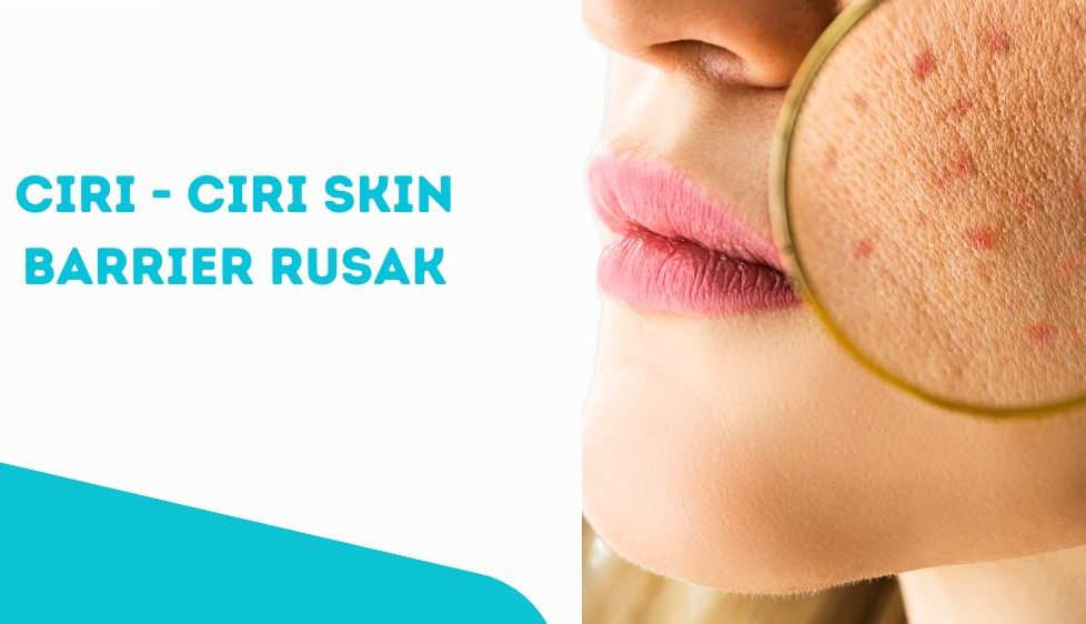 Kerusakan Krim Barrier oleh Polusi, Bagaimana Mengatasi dan Mencegahnya