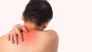 Atasi Gatal dan Nyeri Punggung dengan Notalgia Paresthetica