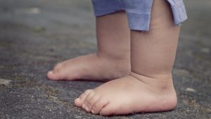 Dampak Aktivitas Berlebihan terhadap Risiko Plantar Juvenil anak